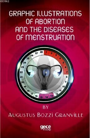 Graphic İllustrations Of Abortion And The Diseases Of Menstruation Aug