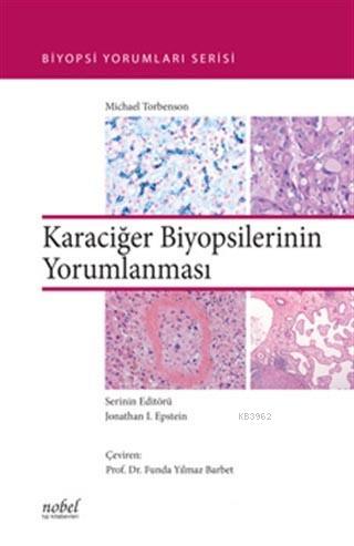 Karaciğer Biyopsilerinin Yorumlanması Kolektif